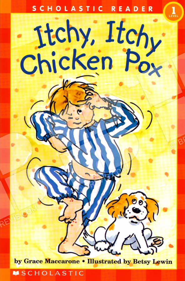 chicken pox with works cited essay chicken pox with works cited essay